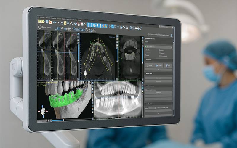 Corso ONE-TO-ONE sul software 3D gratuito BlueSkyPlan
