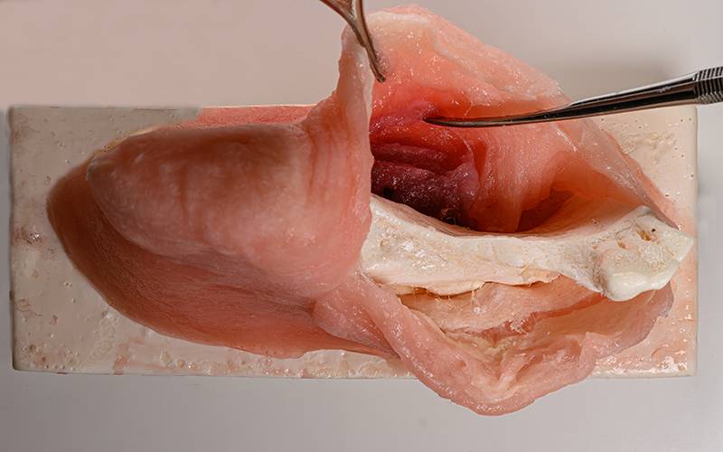 Corso Pratico di Lembi e Suture in Chirurgia Orale e Implantare